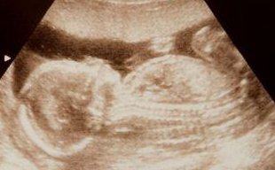 我们一起来了解一下-哈萨克斯坦三代试管婴儿具体流程是怎样的？