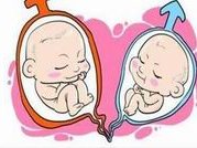 高龄试管怀上双胎想要减胎很困难？