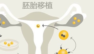 2026年在厦门做试管婴儿全流程需多少天？